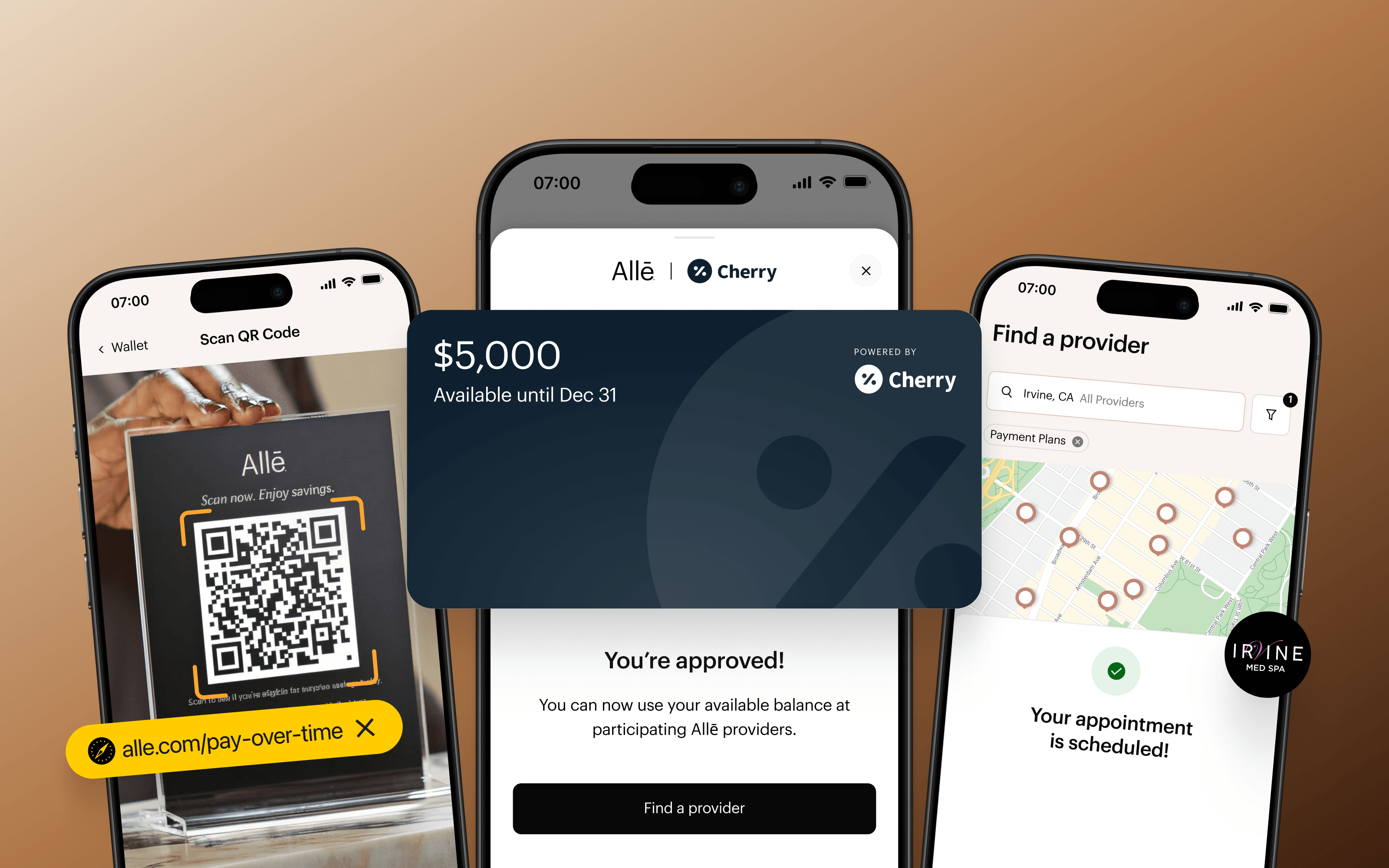 Allē Pay Over Time — patient financing experience